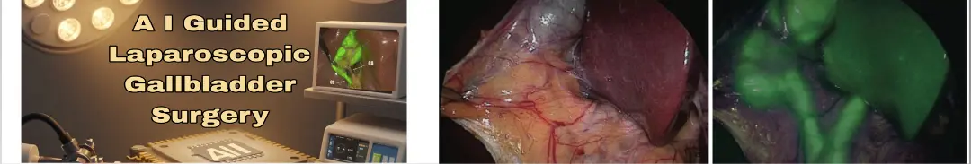 gall bladder